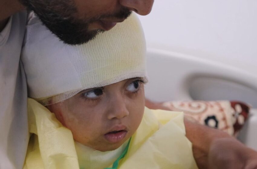  ‘He’s deteriorating every day’: UK urged to admit 11 Gaza children for urgent treatment