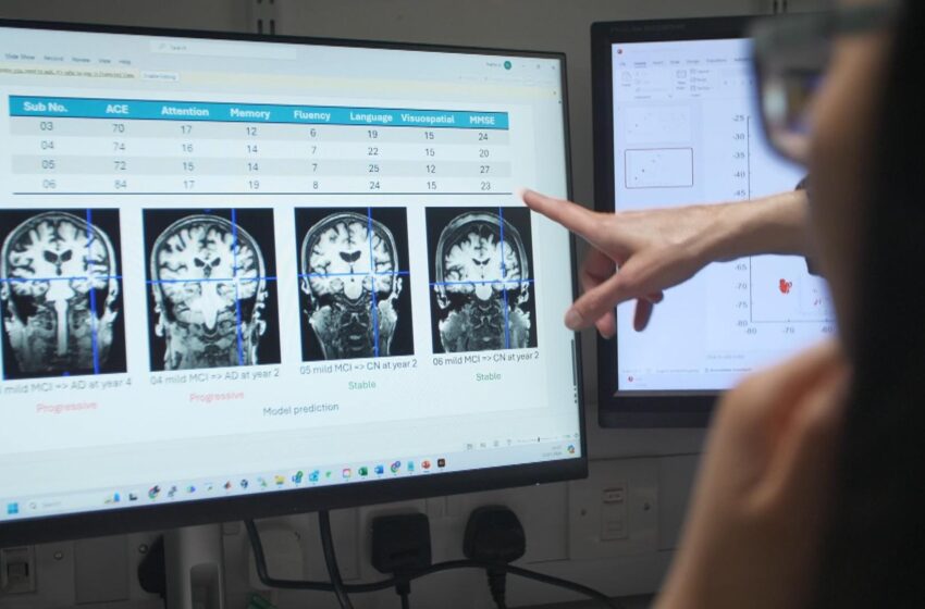  New AI tool could be game-changer in battle against Alzheimer’s