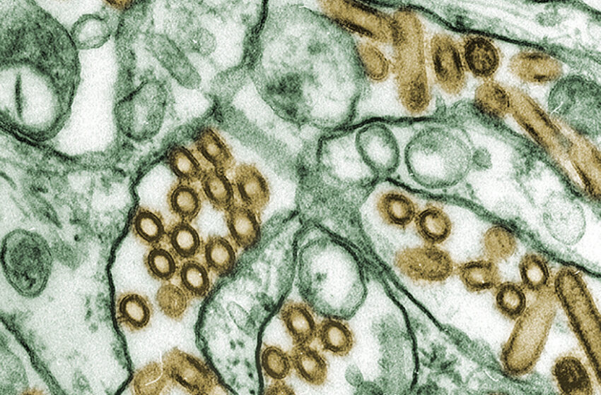 possible-cluster-of-human-bird-flu-infections-expands-in-missouri