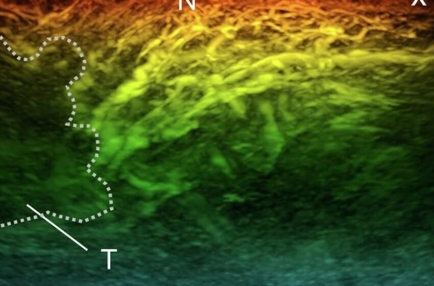  New miniature scanner could revolutionise diagnosis of diseases like cancer and diabetes