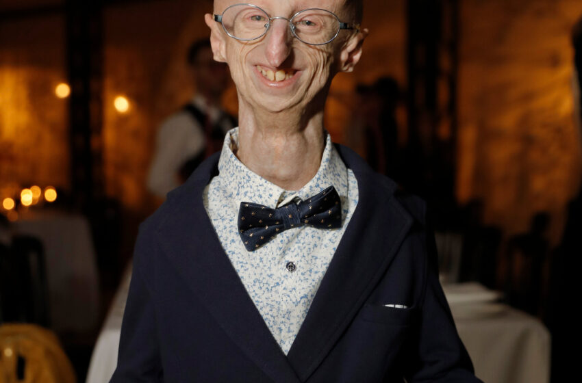  Sammy Basso, Advocate for Progeria Research, Is Dead at 28