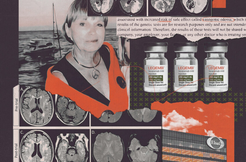  What Drugmakers Did Not Tell Volunteers in Alzheimer’s Trials