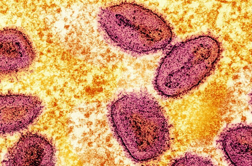 two-more-cases-of-new-mpox-strain-detected-in-uk