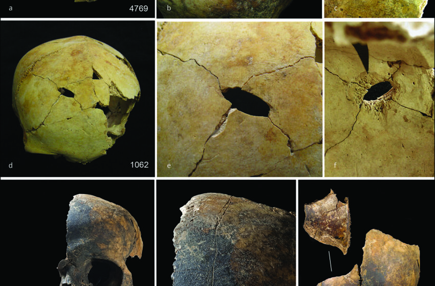  A Grisly Discovery at a Bronze Age Mass Grave: The Victims Were Eaten, Too