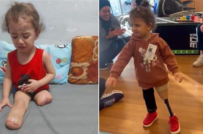  Gazan girl, 3,  who lost both legs under Israeli bombardment walks again